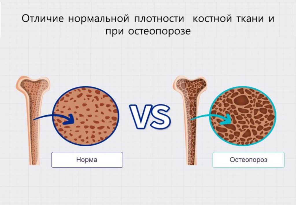 Новый взгляд ученых на Витамин Д - сенсация или ожидаемая новость? - Euromed