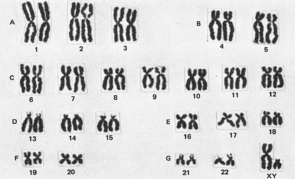 Сколько хромосом у человека здорового