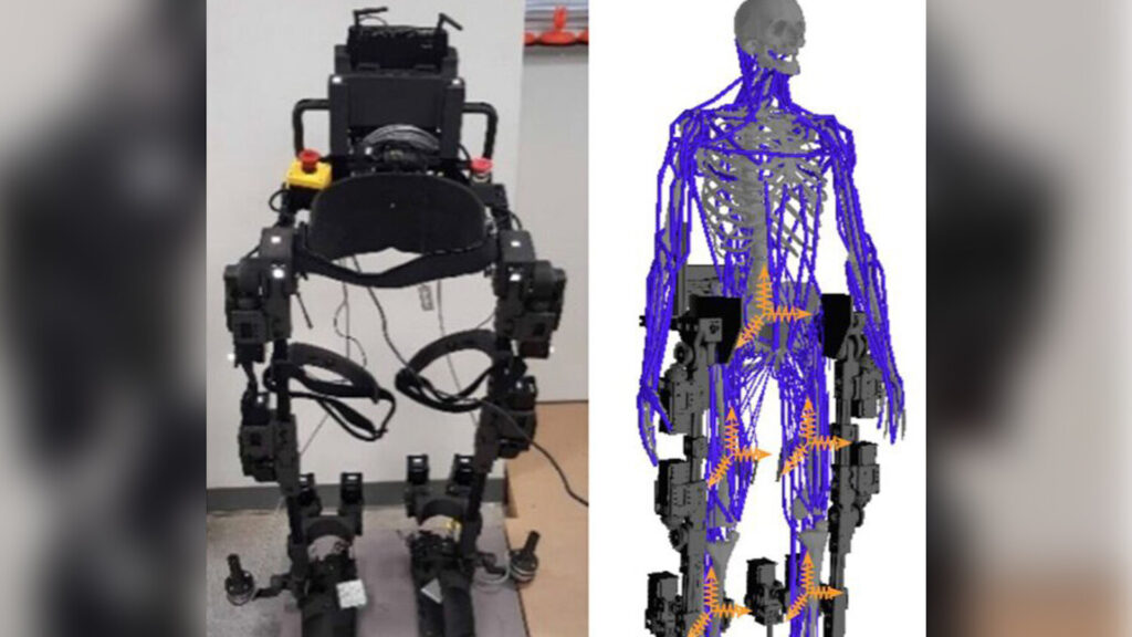 Создана универсальный экзоскелет для восстановления подвижности после инсульта