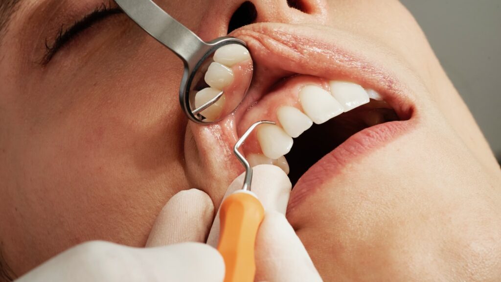Как отбеливающие пасты, газировка и неправильная чистка могут повредить зубы и испортить эмаль