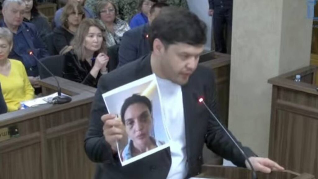 Брат Салтанат Нукеновой показывает фотографию, где она избита Куандыком Бишимбаевым 